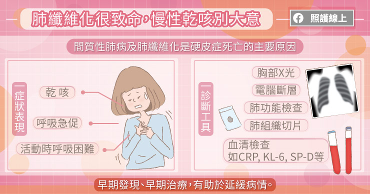 肺纖維化很致命,慢性乾咳別大意!