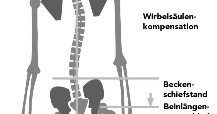 Ein bewusster Weg zur Selbsthilfe bei Bruxismus ...