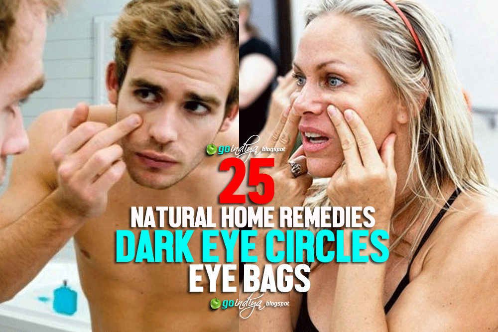25 Home remedies for Dark Eye Circles and Puffy Eyes Natural Home