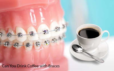 Can You Drink Coffee with Braces