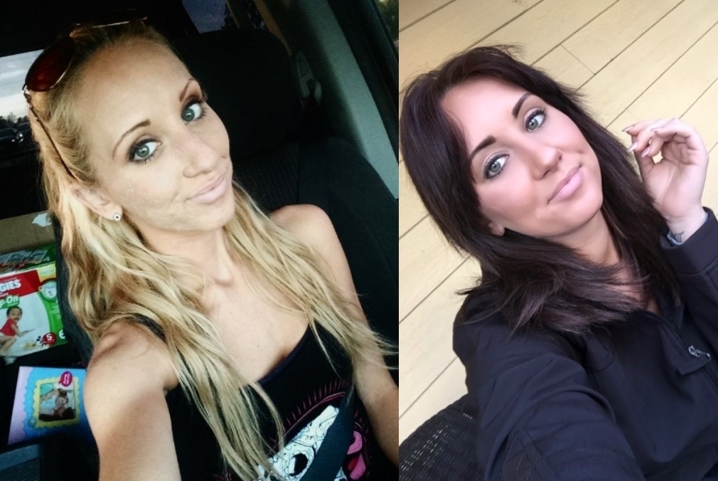 A man shared a photo of his sister who has been meth free for 90 days. - Powerful Before/After Photos Of Women Who QUIT Drugs. A man shared a photo of his sister who has been meth free for 90 days. - Powerful Before/After Photos Of Women Who QUIT Drugs.