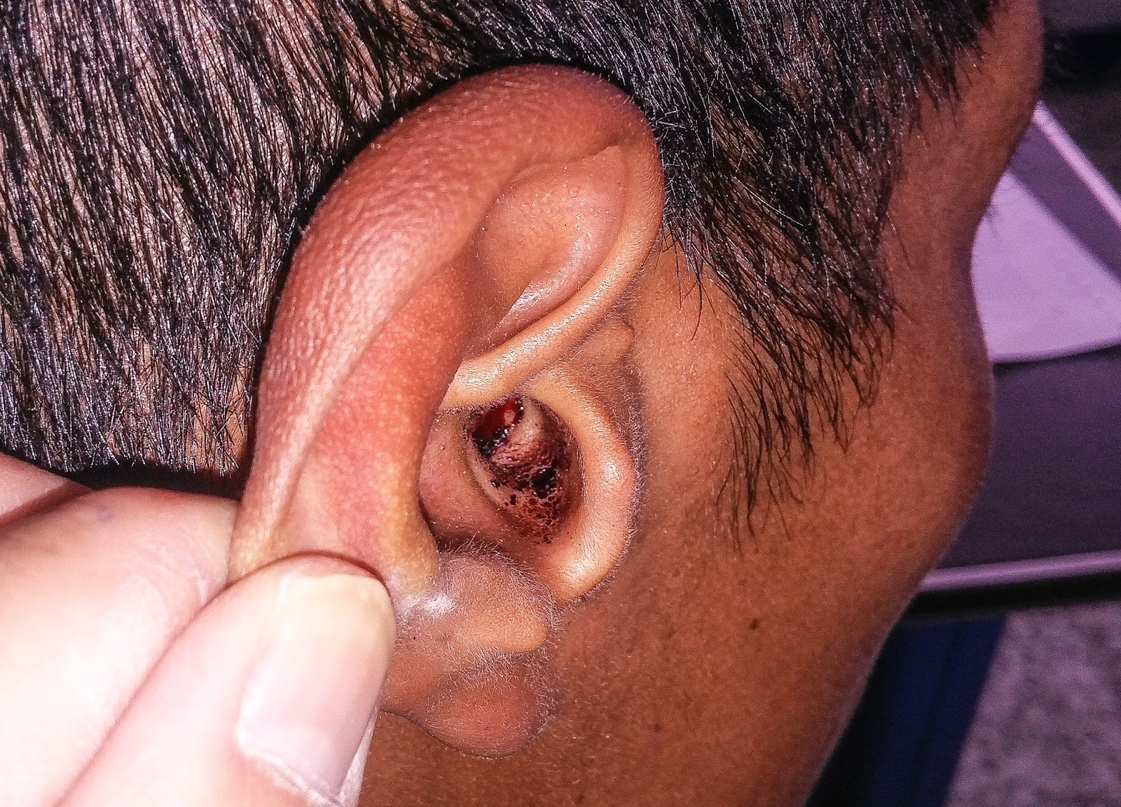 Basics Of Neuroscience Flashcards Quizlet