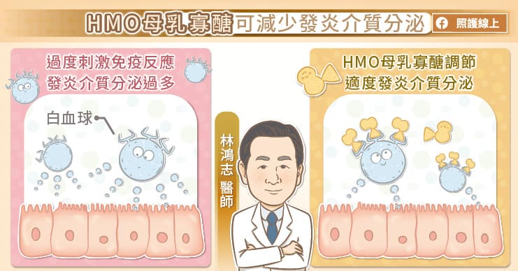 HMO母乳寡醣可減少發炎介質分泌
