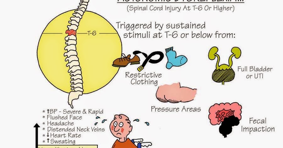 a-prisoner-of-the-system-autonomic-dysreflexia-mark-it-down-could