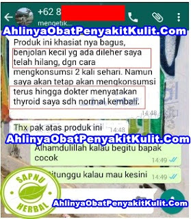 Cara Menghilangkan Benjolan Di Belakang lutut Secara Alami Cara Menghilangkan Benjolan Di Belakang lutut Secara Alami