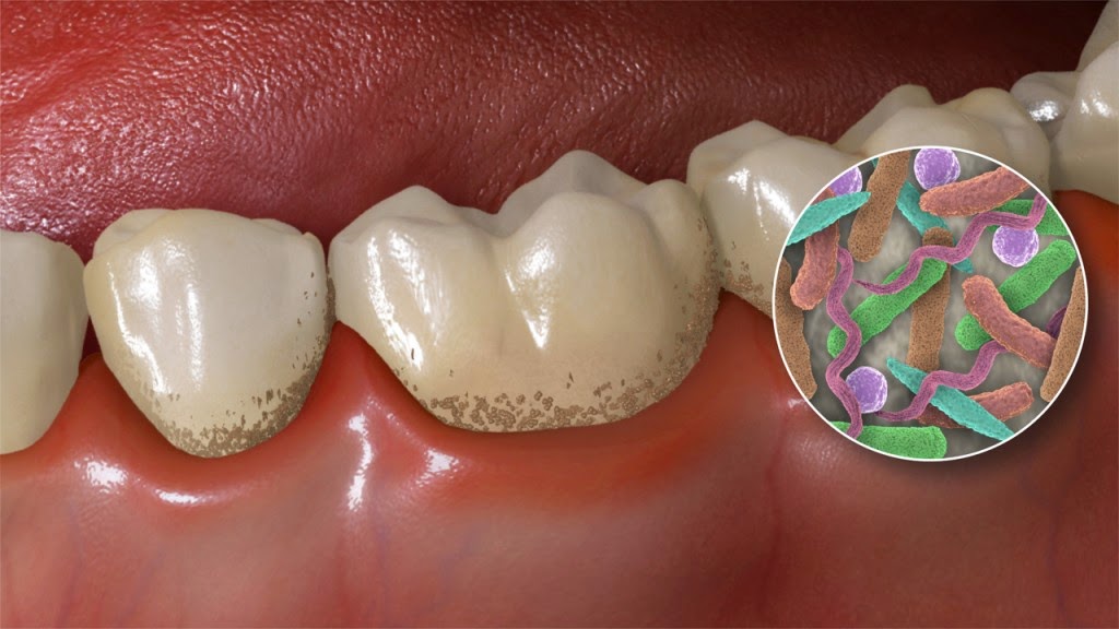 Central Saber: Bactérias na boca