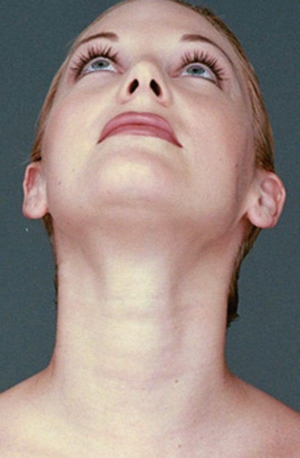 Facelifts Without Surgery Using Face Yoga Exercises Double Chin