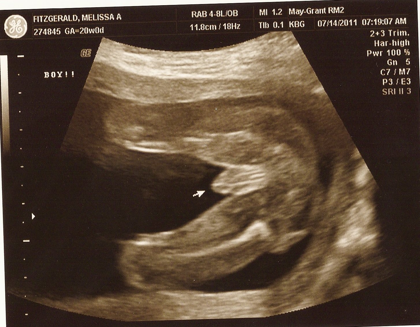 baby boy sonogram baby boy sonogram