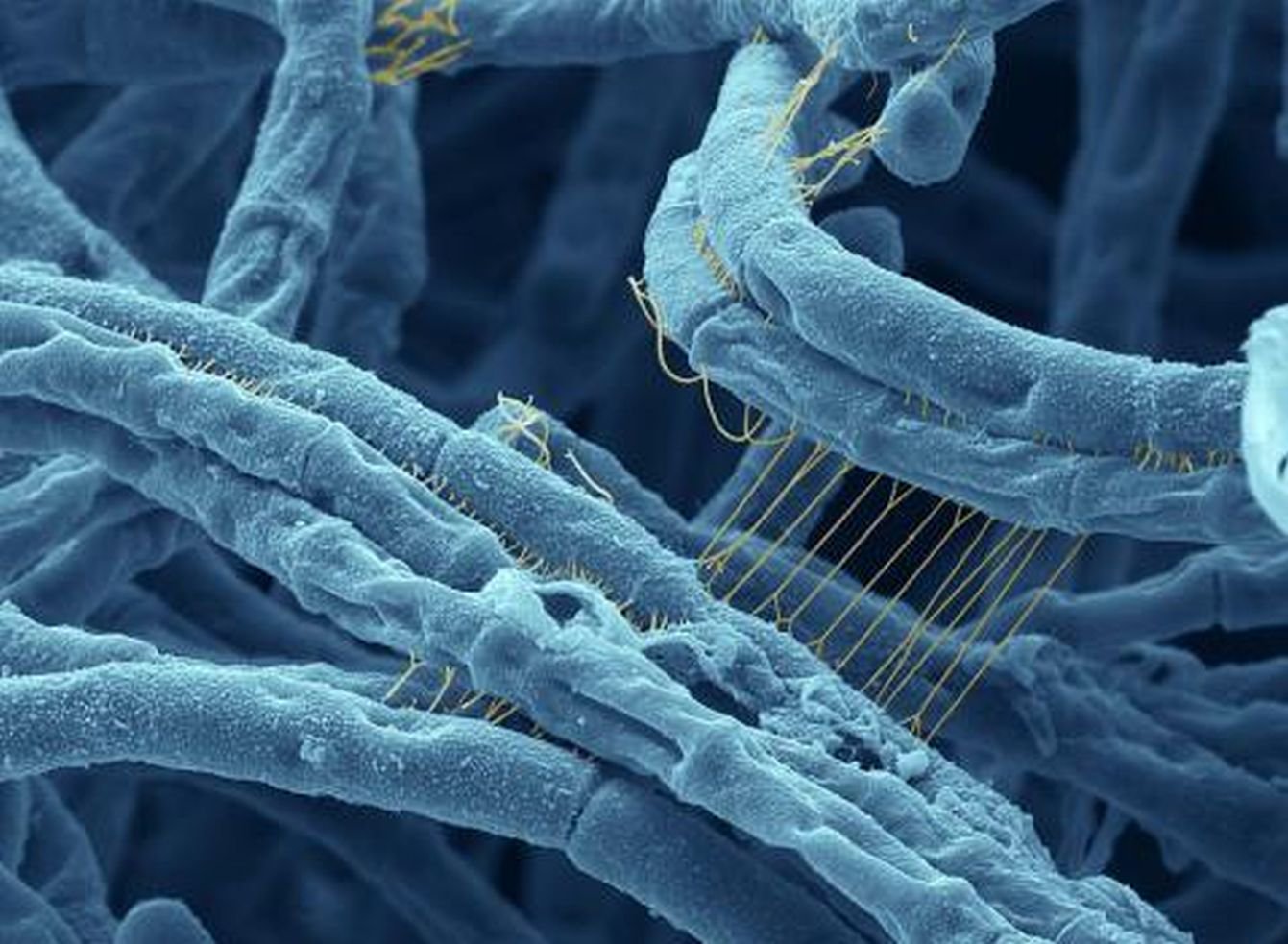 Eat well inspected, proper cooked meat over Anthax Bacteria Embu