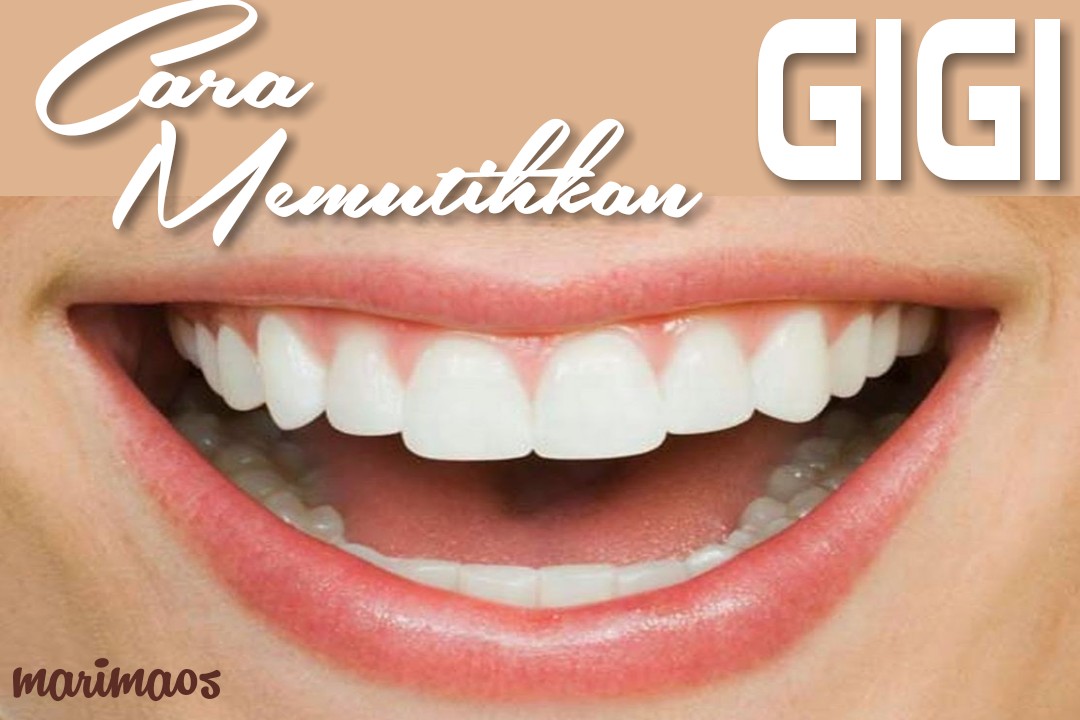 Cara Menghilangkan Plak Kuning Di Gigi Agar Gigi Putih Bersih