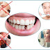 Chăm sóc răng implant như thế nào mới đúng cách?