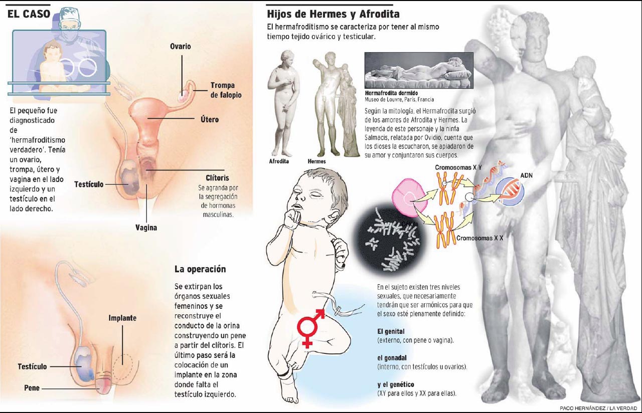 Featured image of post Hermafrodita Humano Fotos Medicina