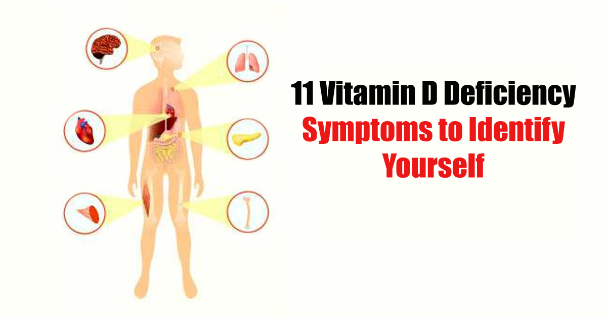 Vitamin deficiency. Vitamin d deficiency. Vitmain d deficiency Symptoms. Vitamin в3 deficiency Symptoms.