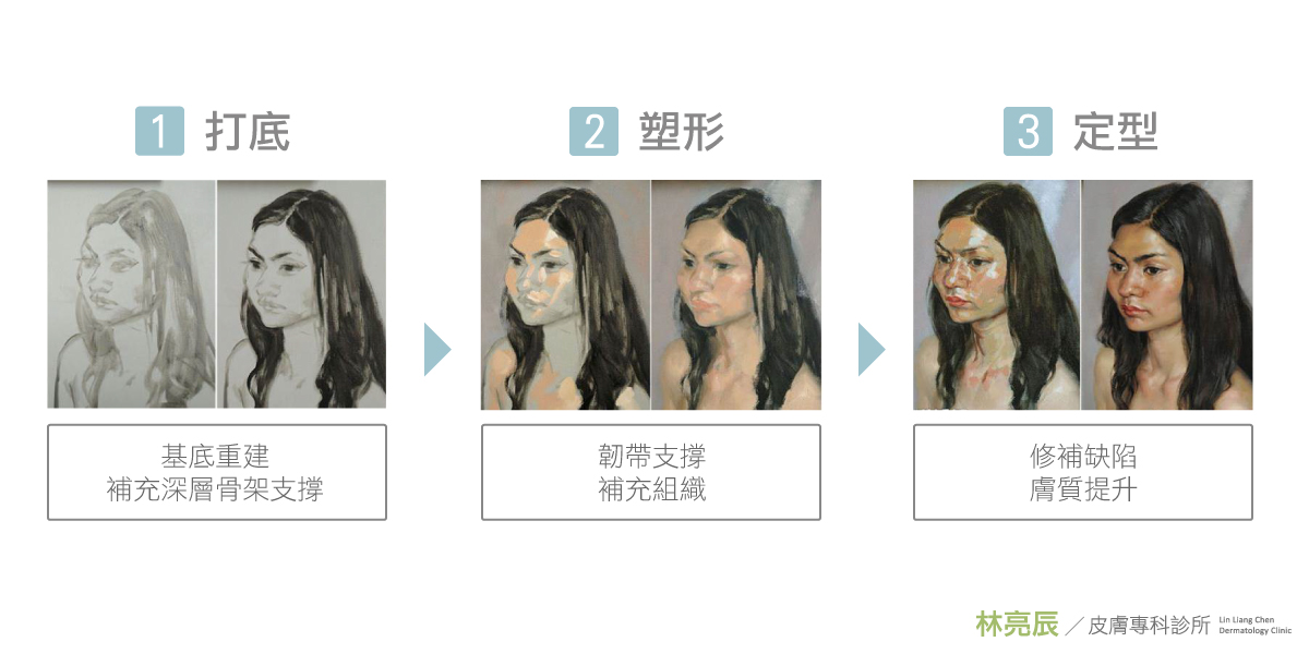 【舒顏萃心得】舒顏萃術後緊實、拉提超自然 變年輕氣色變好超滿意