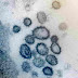 COVID-19: Genetic network analysis provides 'snapshot' of pandemic origins