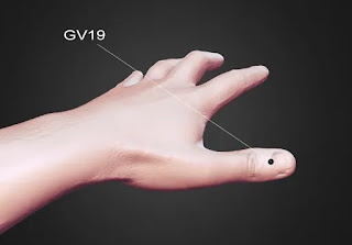 Fast Treatment of Insomnia through Acupressure points | Twelve Meridian gv19-acupressure-point-for-insomnia