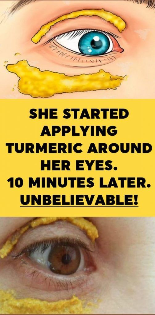 She Started Applying Turmeric Around Her Eyes. 10 Minutes Later