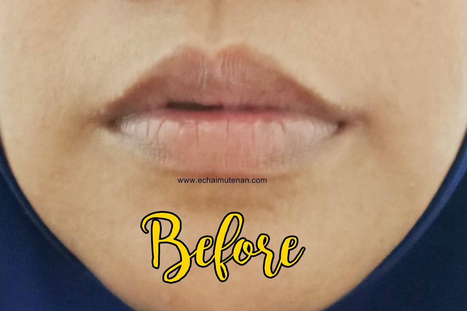 Cerita Cha Pure Paw Paw Oinment Untuk Kelembaban Bibir Dan Kulit