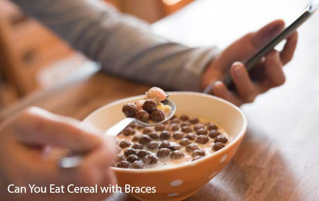 Can You Eat Cereal with Braces