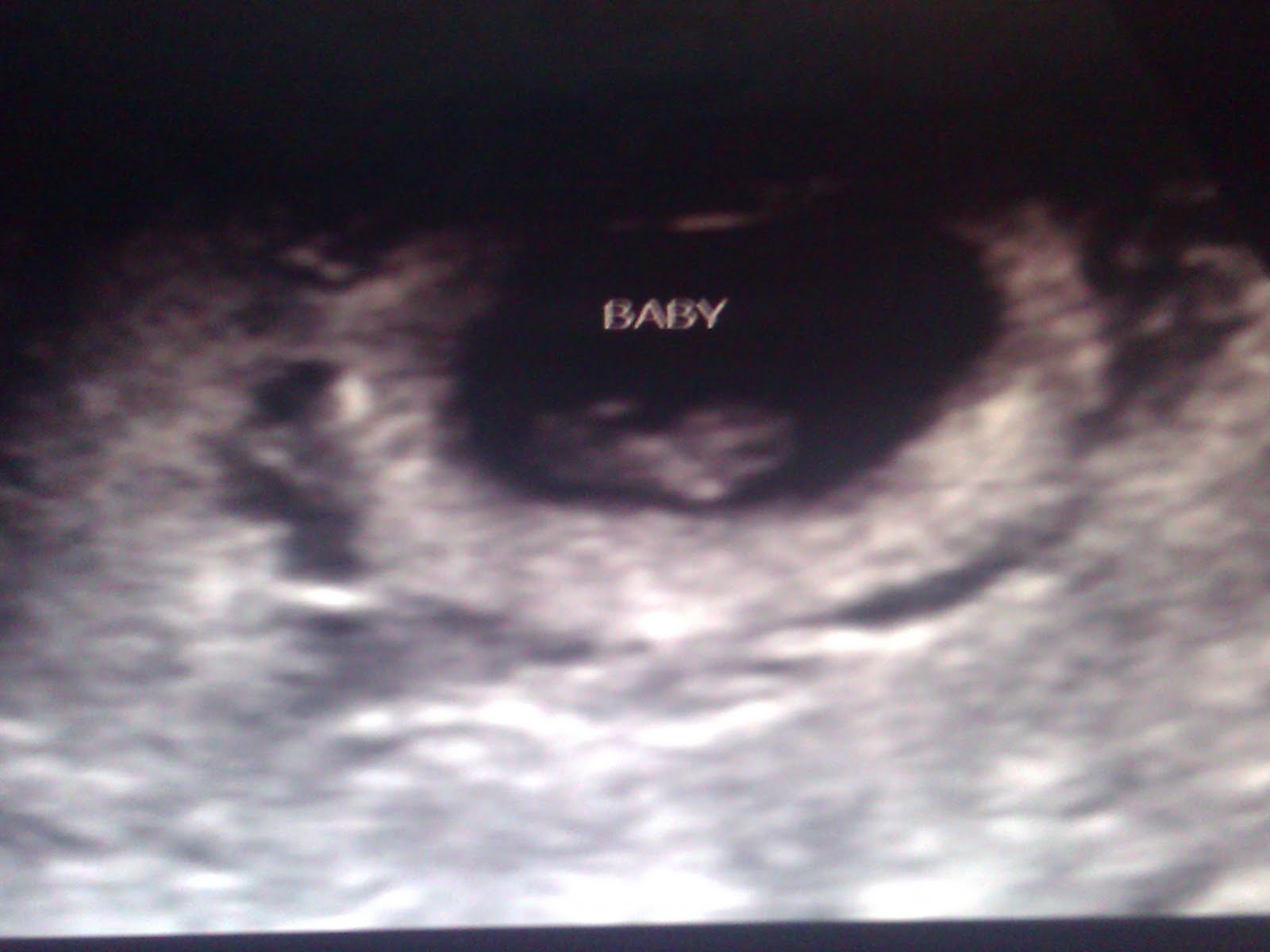 What Your Baby At 8 Weeks Ultrasound Reveals About Their Future - 2jrx948
