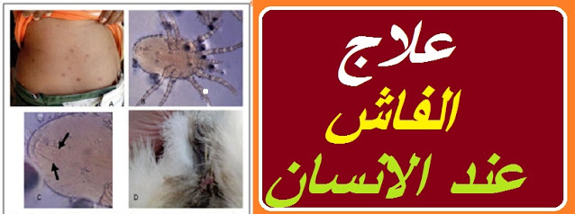 "حشرة الفاش في المنزل" "القضاء على الفاش نهائيا من المنزل" "هل الكلور يقتل الفاش" "حشرة الفاش والانسان" "شكل الفاش الأبيض" "التخلص من الفاش نهائيا من المنزل" "كيف اقضى على الفاش في المنزل" "هل فاش الطيور يعدى الانسان" حشرة الفاش ويكيبيديا " حشرة الفاش الأبيض في المنزل" حشرة الفاش الأبيض" حشرة الفاش" " علاج حشرة الفاش " فاش الطيور حشرة الفاش" حشرة الفاش الابيض 0" حشرة الفاش في المنزل" حشرة الفاش في الطيور" حشرة العلقة" حشرة الجرب" حشرة الحمام" حشرة قمل الحمام" " ما هي حشرة الفاش" حشرة الفاش فى المنزل" حشرة الفاش والانسان" حشرة فاش الحمام" " شكل حشرة الجرب" حشرة الفاش فاش الحمام" حشرة البغبش" حشرة الفاش الأسود" حشرة القميلة" شكل حشرة الفاش" كيفية التخلص من حشرة الفاش فى المنزل" شكل حشرة فاش الطيور" فاش شكل حشرة الفاش" الارنب حشرة" أضرار حشرة السوس" هل الخل يقتل الفاش التخلص من الفاش نهائيا القضاء على الفاش من المنزل القضاء على الفاش نهائيا من المنزل علاج الفاش بالحلبه علاج الفاش عند الانسان علاج الفاش بالثوم هل الفاش ينتقل للانسان حشرة الفاش في المنزل القضاء على الفاش نهائيا من المنزل الفاش الابيض هل الكلور يقتل الفاش شكل الفاش الأبيض كيف اقضى على الفاش في المنزل التخلص من الفاش نهائيا من المنزل علاج قرص الفاش للانسان "حشرة الفاش في المنزل" "القضاء على الفاش نهائيا من المنزل" "هل الكلور يقتل الفاش" "حشرة الفاش والانسان" "شكل الفاش الأبيض" "التخلص من الفاش نهائيا من المنزل" "كيف اقضى على الفاش في المنزل" "هل فاش الطيور يعدى الانسان" حشرة الفاش ويكيبيديا " حشرة الفاش الأبيض في المنزل" حشرة الفاش الأبيض" حشرة الفاش" " علاج حشرة الفاش " فاش الطيور حشرة الفاش" حشرة الفاش الابيض 0" حشرة الفاش في المنزل" حشرة الفاش في الطيور" حشرة العلقة" حشرة الجرب" حشرة الحمام" حشرة قمل الحمام" " ما هي حشرة الفاش" حشرة الفاش فى المنزل" حشرة الفاش والانسان" حشرة فاش الحمام" " شكل حشرة الجرب" حشرة الفاش فاش الحمام" حشرة البغبش" حشرة الفاش الأسود" حشرة القميلة" شكل حشرة الفاش" كيفية التخلص من حشرة الفاش فى المنزل" شكل حشرة فاش الطيور" فاش شكل حشرة الفاش" الارنب حشرة" أضرار حشرة السوس" هل الخل يقتل الفاش التخلص من الفاش نهائيا القضاء على الفاش من المنزل القضاء على الفاش نهائيا من المنزل علاج الفاش بالحلبه علاج الفاش عند الانسان علاج الفاش بالثوم هل الفاش ينتقل للانسان حشرة الفاش في المنزل القضاء على الفاش نهائيا من المنزل الفاش الابيض هل الكلور يقتل الفاش شكل الفاش الأبيض كيف اقضى على الفاش في المنزل التخلص من الفاش نهائيا من المنزل علاج قرص الفاش للانسان