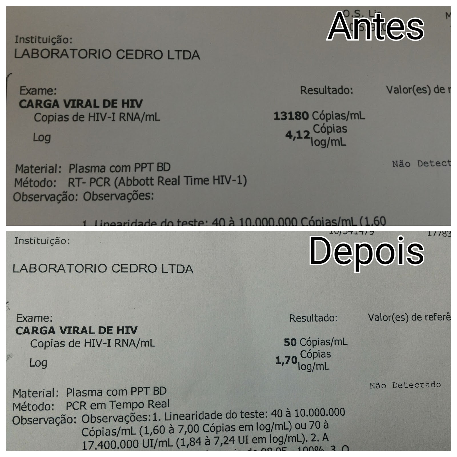 Hiv Positivo Hiv Positivo