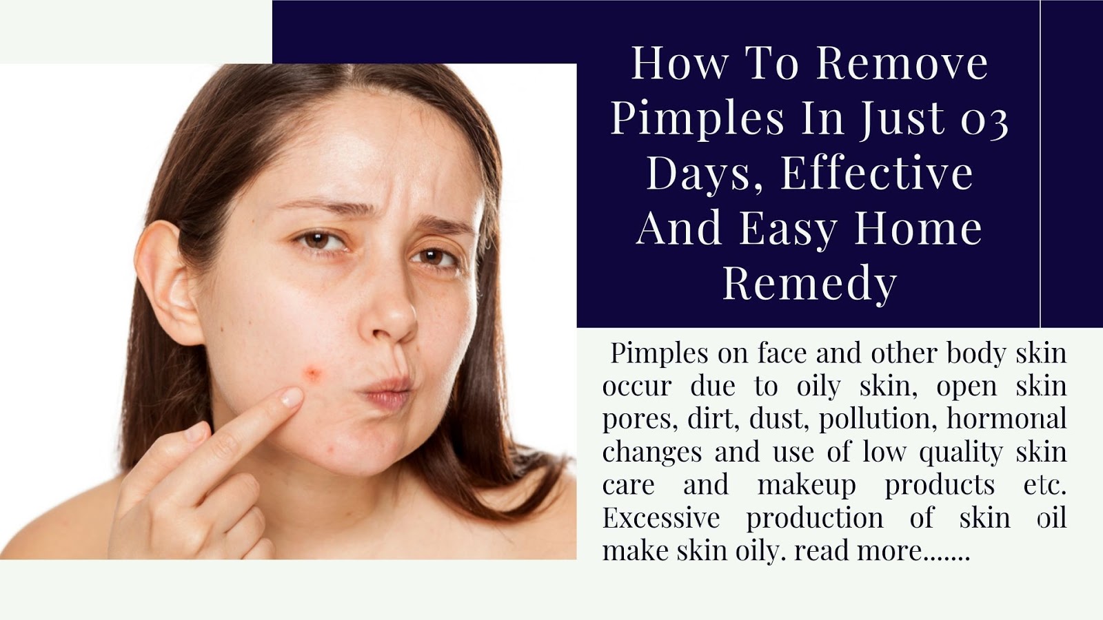 How To Remove Pimples In Just 03 Days, Effective And Easy Home Remedy