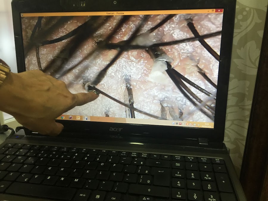 Oxigenación capilar, el tratamiento que le devolverá la salud y el brillo a tu pelo