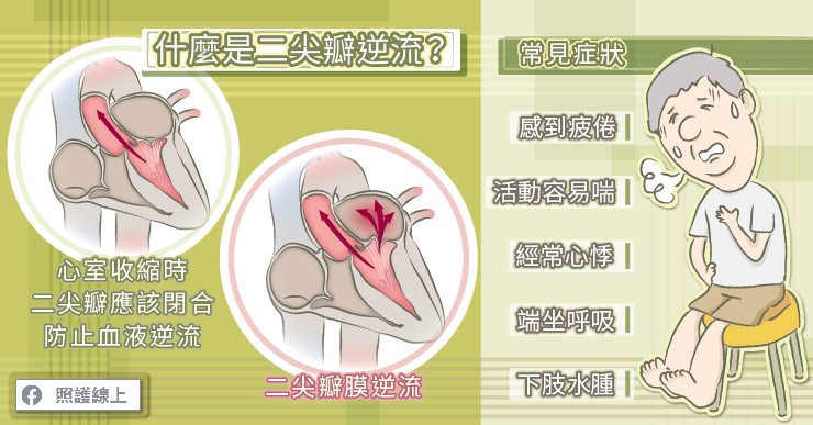 二尖瓣逆流要注意