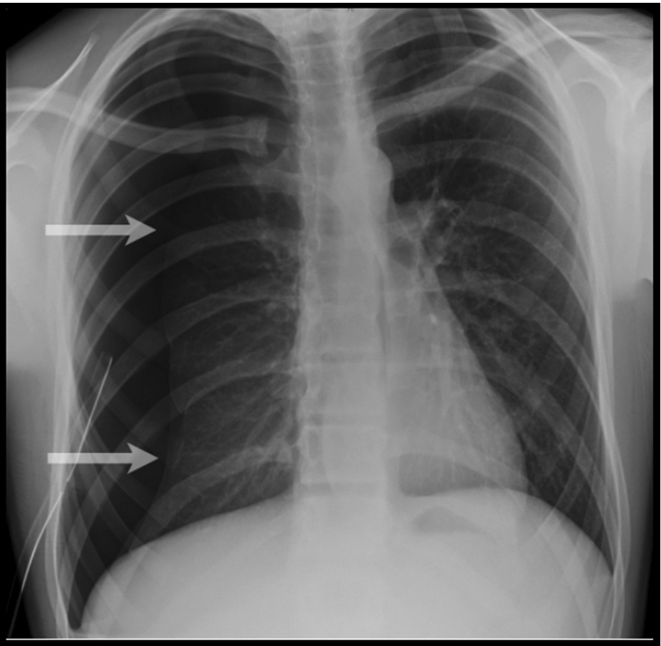 Study Medical Photos A 25 Year Old Man Presents With 3 Day History Of