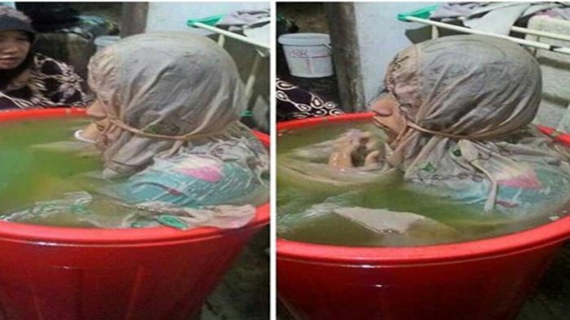 Kisah Haru Gadis yang Mendadak Terkena Gangguan Jiwa saat