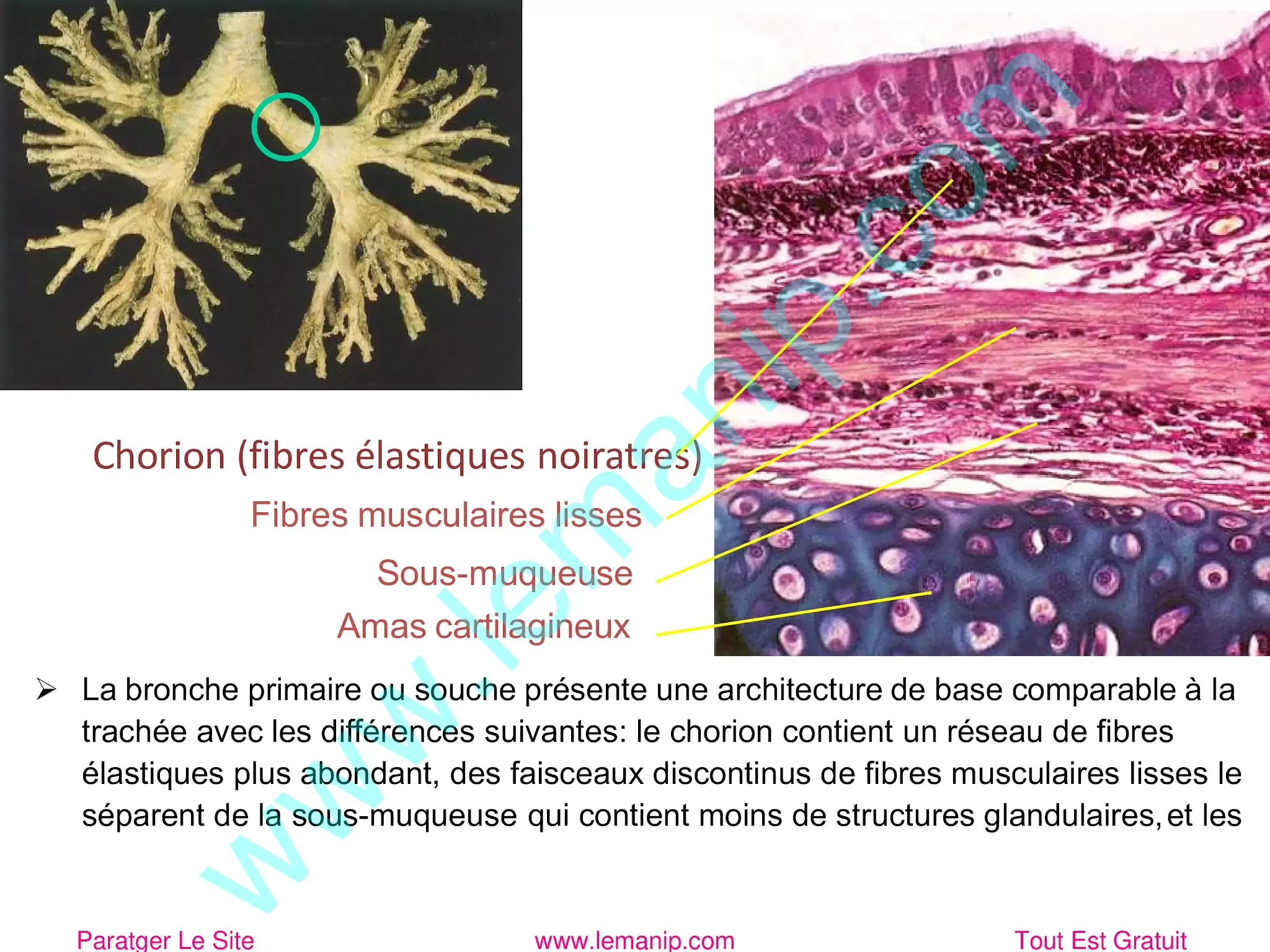 La bronche primaire