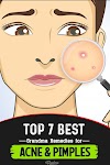 Best Remedies To Prevent Pimples