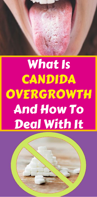 What Is Candida Overgrowth And How To Deal With It
