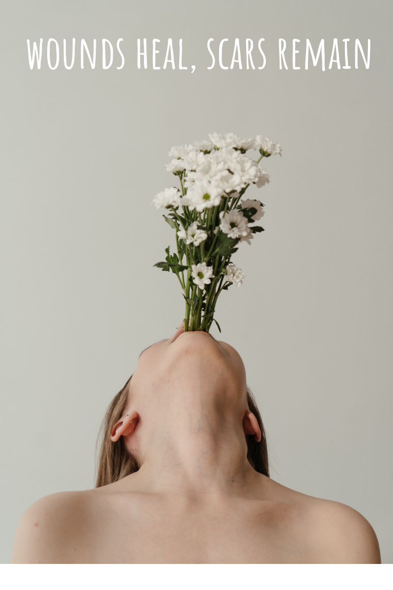 WOUNDS HEAL, SCARS REMAIN