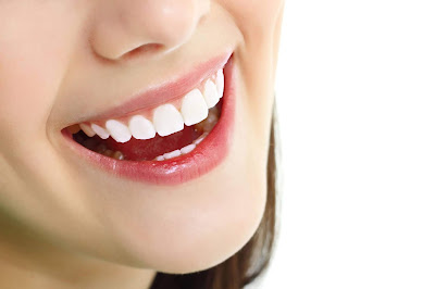 Răng sứ có bị đổi màu không? Cách nào kéo dài thẩm mỹ cho răng-3?
