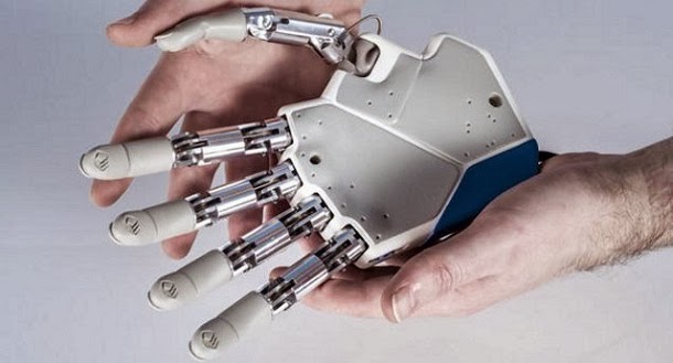 Resultado de imagem para IMAGEM PARA PROTESE DE MÃO