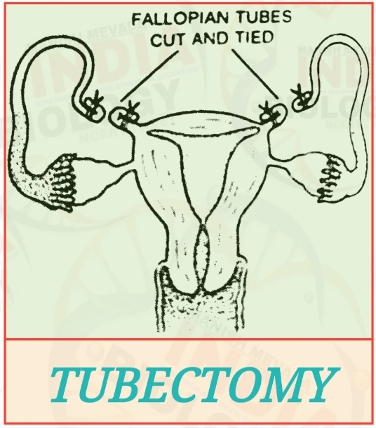 Permanent Methods of Birth control, MTP & STDs NEET BIOLOGY