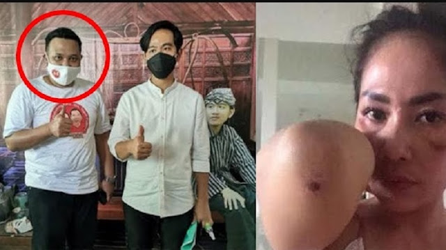 Polisi Sebut Pelaku Penganiayaan Pacar Bukan Timses Gibran, Cuma Berfoto Saja Polisi Sebut Pelaku Penganiayaan Pacar Bukan Timses Gibran, Cuma Berfoto Saja
