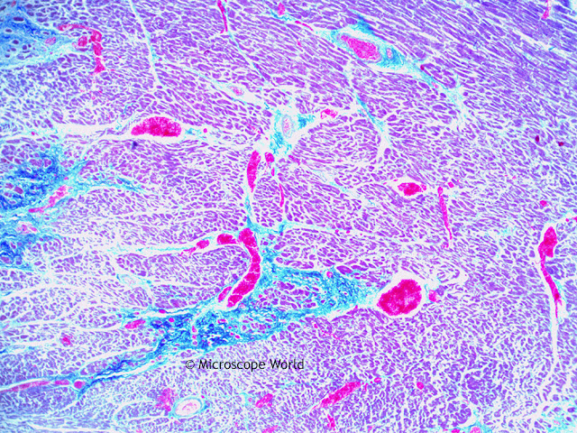 Microcope World image of human cardiac muscle captured at 40x.