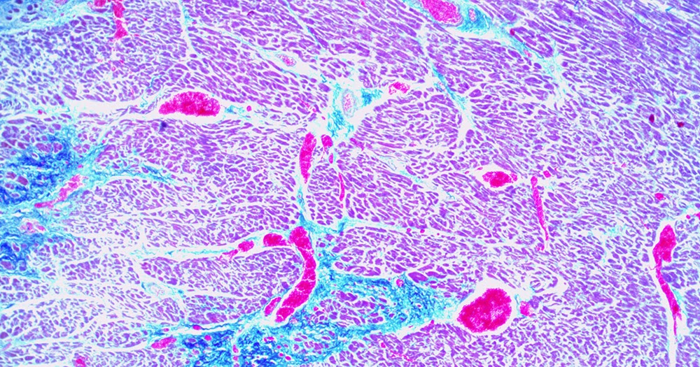 Microscope World Blog: Human Cardiac Muscle under the Microscope