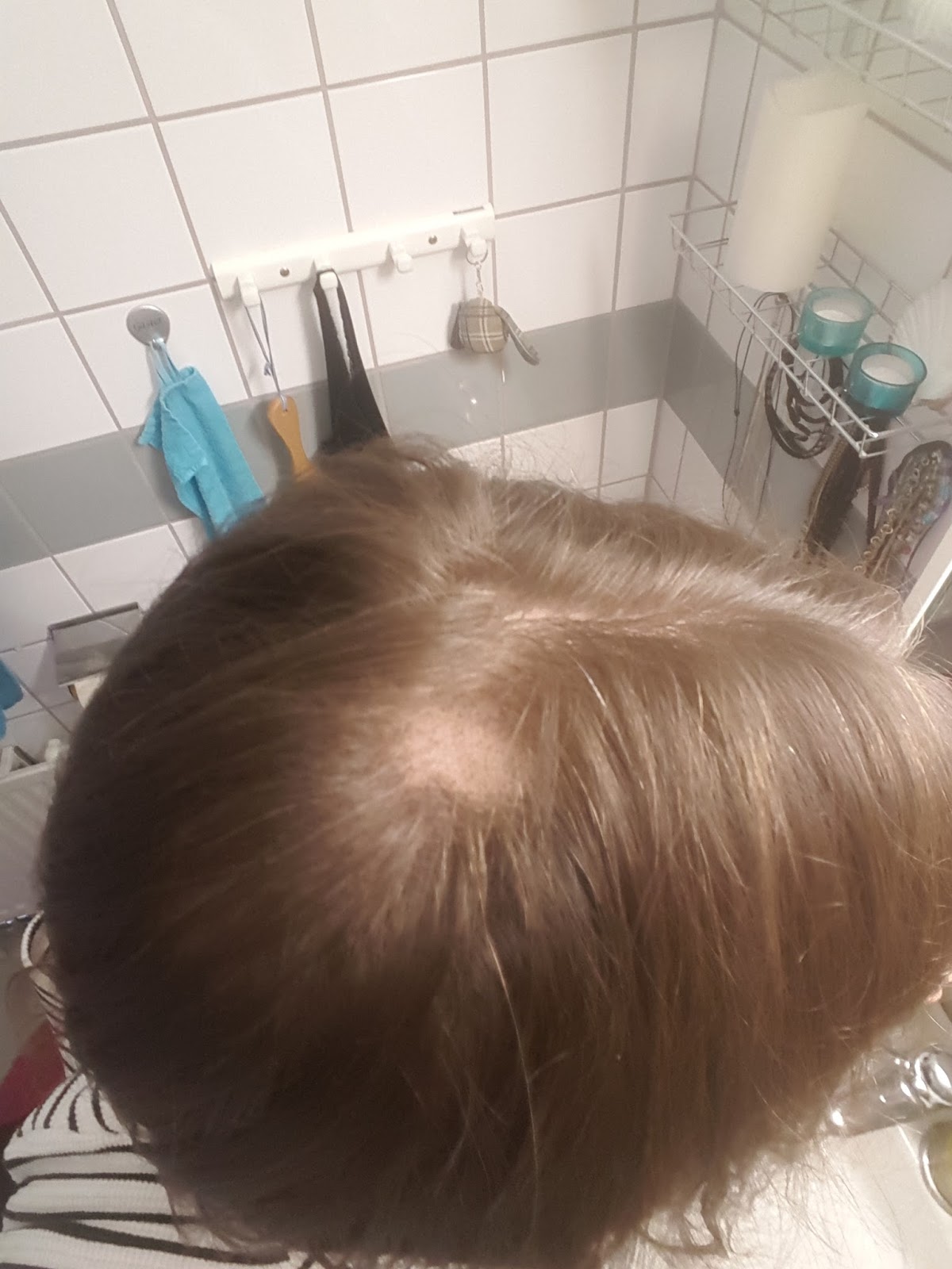 tunnare hår på hjässan