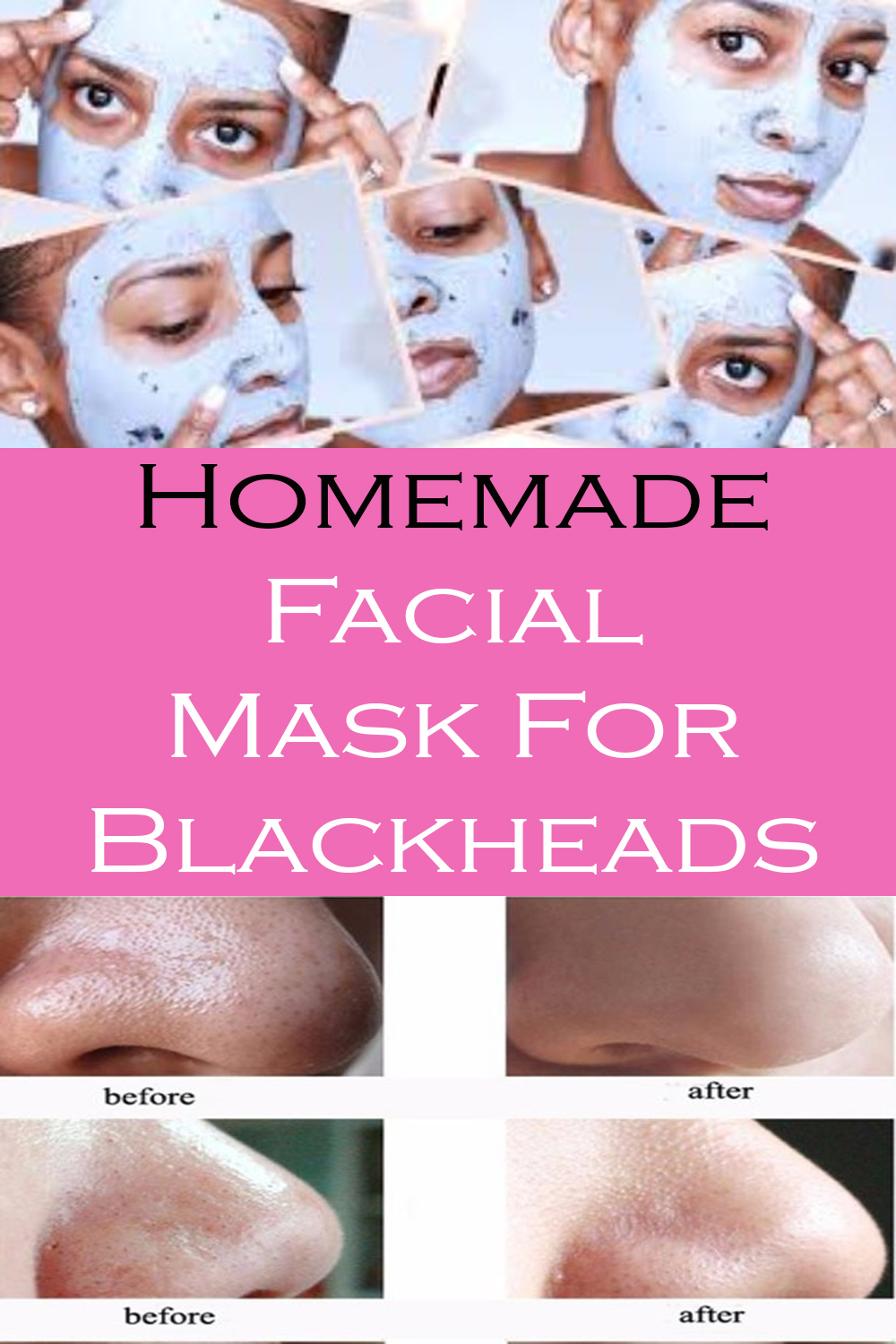 Homemade Facial Mask For Blackheads thebestnaturalbeauty