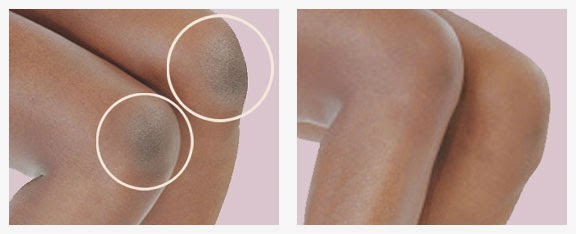 Cara memutihkan Lutut Hitam Alami