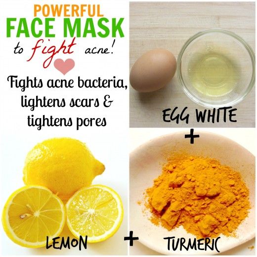 Egg white and Lemon juice Face Mask for Acne