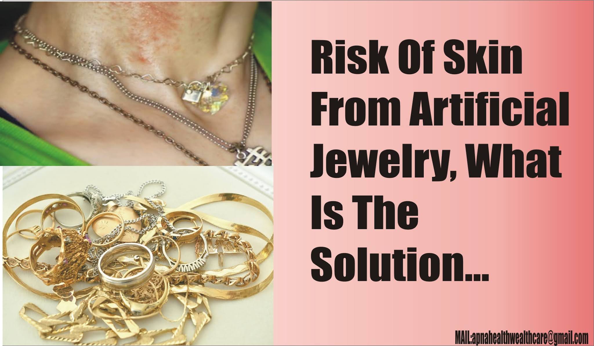 APNA HEALTH WEALTH CARE Risk Of Skin From Artificial Jewelry, What Is