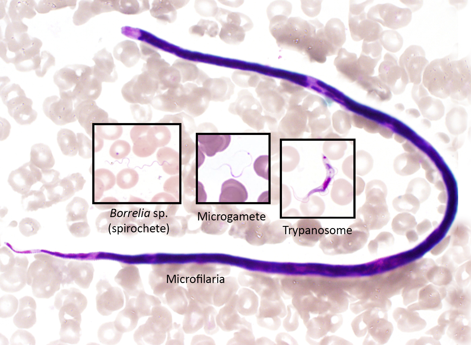 Иксодовый клещевой боррелиоз возбудитель. Borrelia burgdorferi цикл. Кольцевая эритема боррелиоза. Трепонемы боррелии лептоспиры. Диагноз иксодовый клещевой боррелиоз.