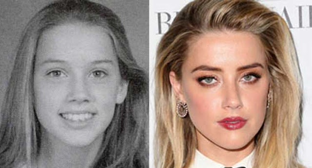 Amber Heard Plastic Surgery After and Before.