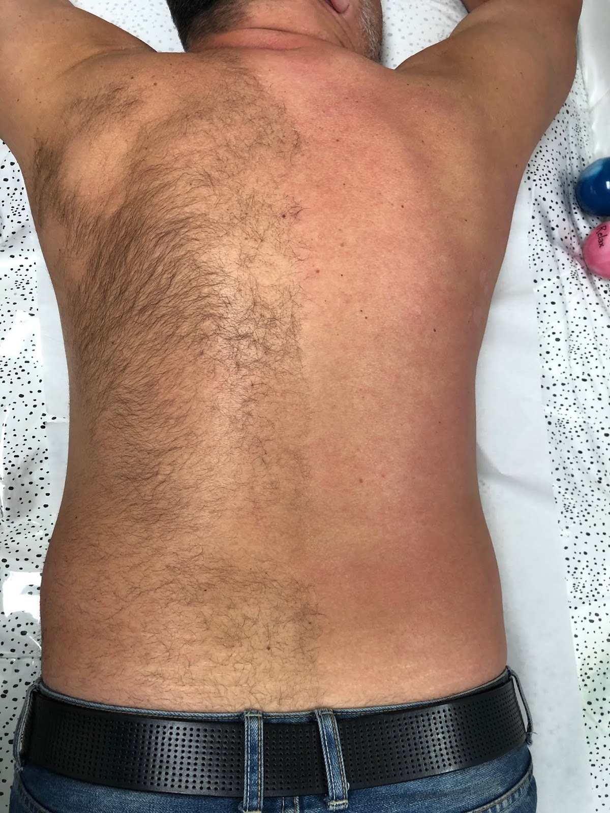 Back Waxing for men: is it worth it?