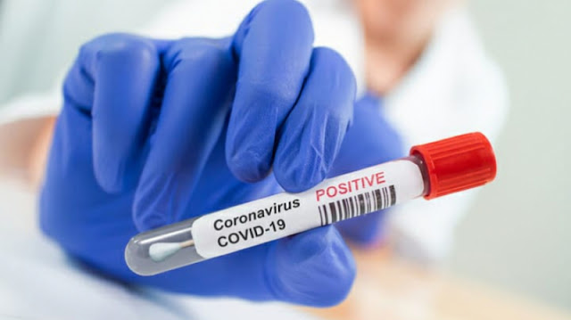 المهدية : تسجيل 31 إصابة جديدة بفيروس كورونا